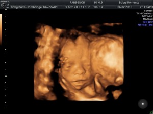 4D Baby scan